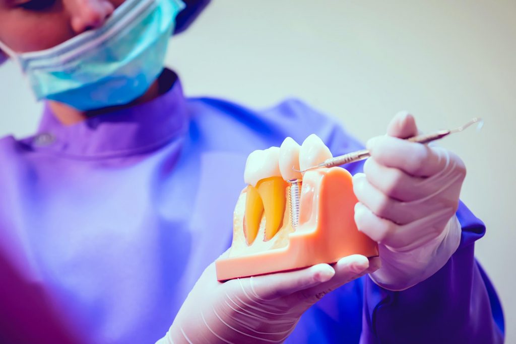 Dental Implants - Mint Leaf Dental Clinic in Markham
