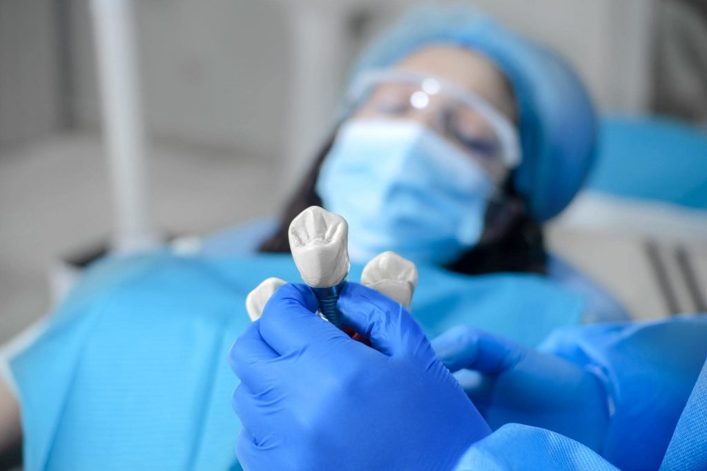 Dental Implants - Mint Leaf Dental Clinic in Markham