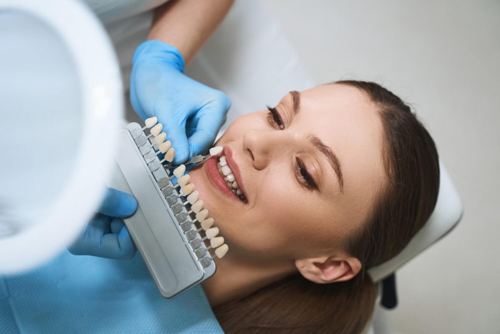 Dental Veneers - Mint Leaf Dental Clinic in Markham